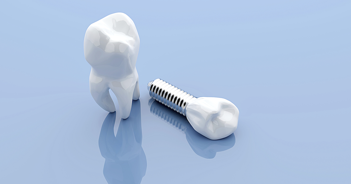 Dental implant and teeth, isolated on blue medical background
