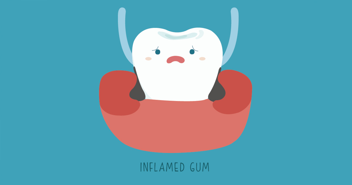 dca-blog-gum-disease_1200x630